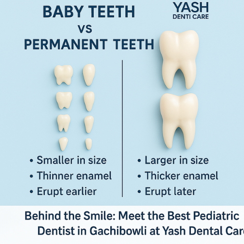 Comparison of baby teeth and permanent teeth with differences in size, structure, and eruption timeline